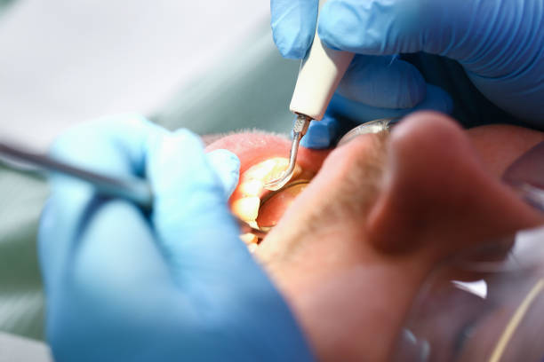 Best Emergency Orthodontic Repairs in Hartwell, GA